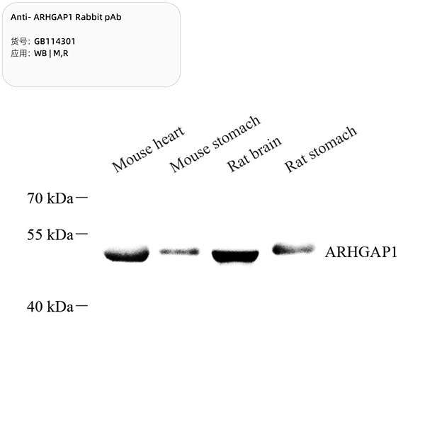 Антитела первичные, поликлональные, ARHGAP1, 100 мкл