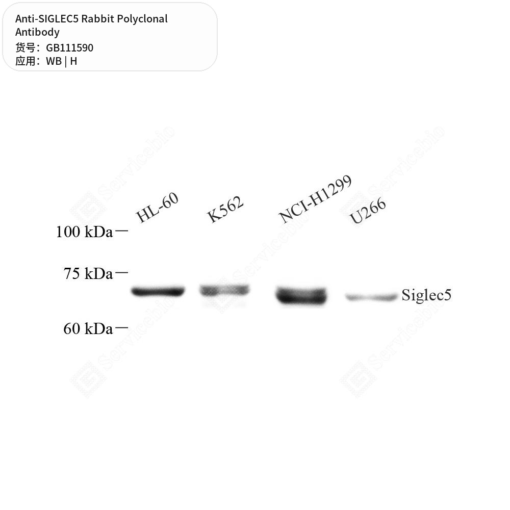 Антитела первичные, поликлональные кролика к SIGLEC5 человека, 100 мкл