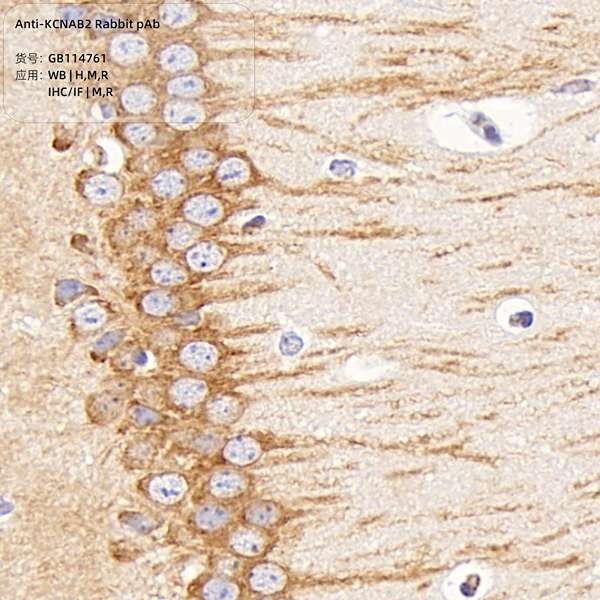 Антитела первичные, поликлональные, KCNAB2, 100 мкл