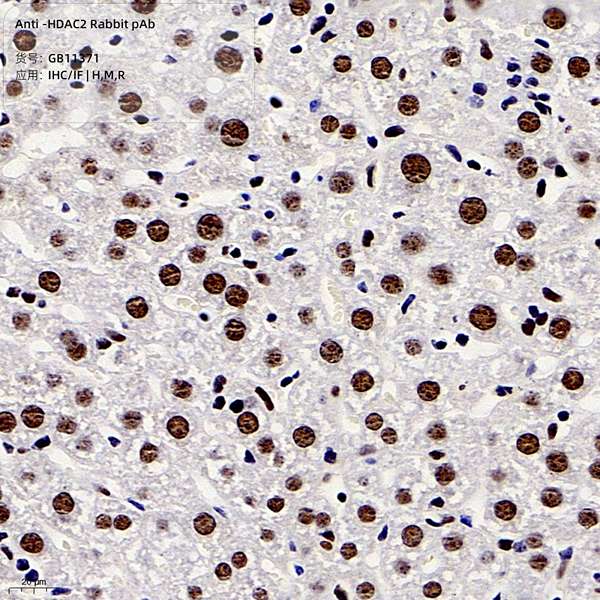 Антитела первичные, поликлональные, HDAC2, 100 мкл
