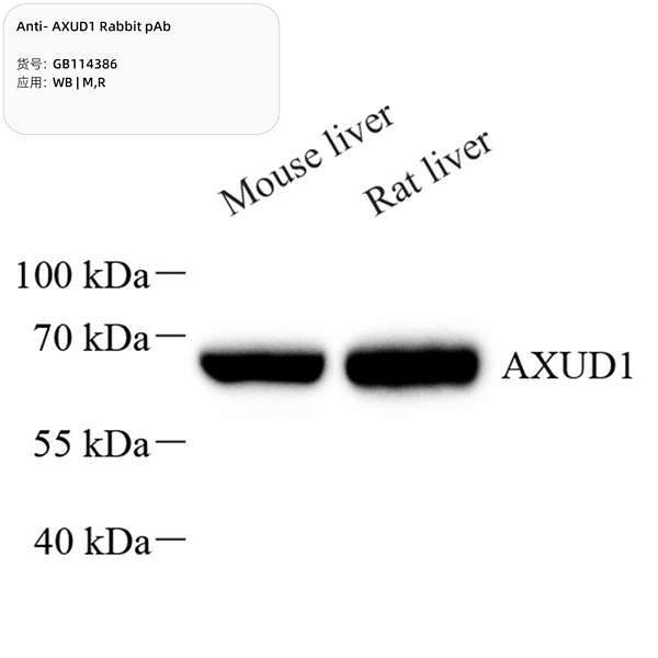 Антитела первичные, поликлональные, AXUD1, 100 мкл