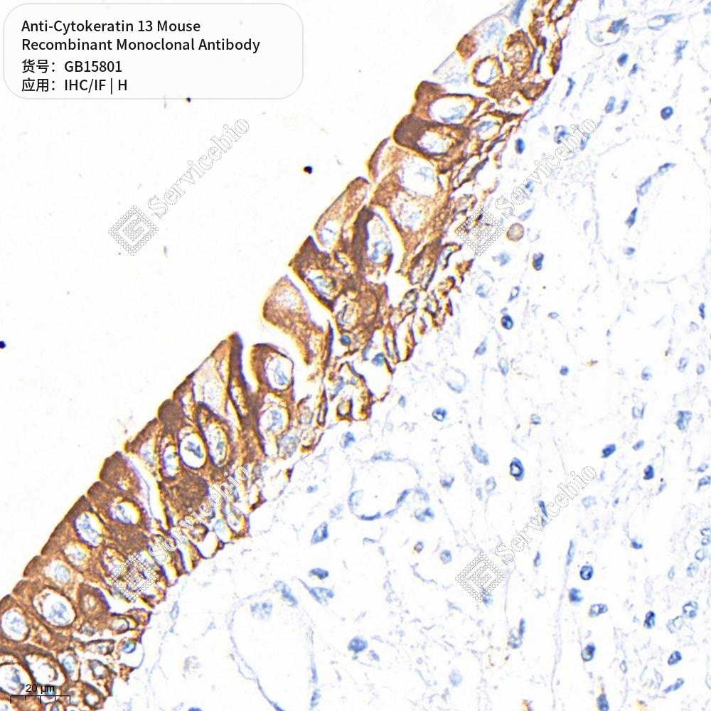 Антитела первичные, моноклональные мыши к Cytokeratin 13 человека, 100 мкл