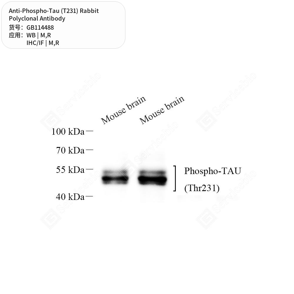 Антитела первичные, поликлональные кролика к Phospho-Tau (T231) крысы, мыши, 100 мкл