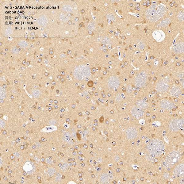 Антитела первичные, поликлональные, GABA A Receptor alpha 1, 100 мкл