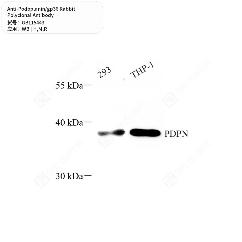 Антитела первичные, поликлональные кролика к Podoplanin/gp36 крысы, мыши, человека, 50 мкл