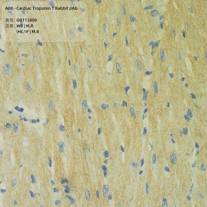 Антитела первичные, поликлональные, Cardiac Troponin T, 100 мкл