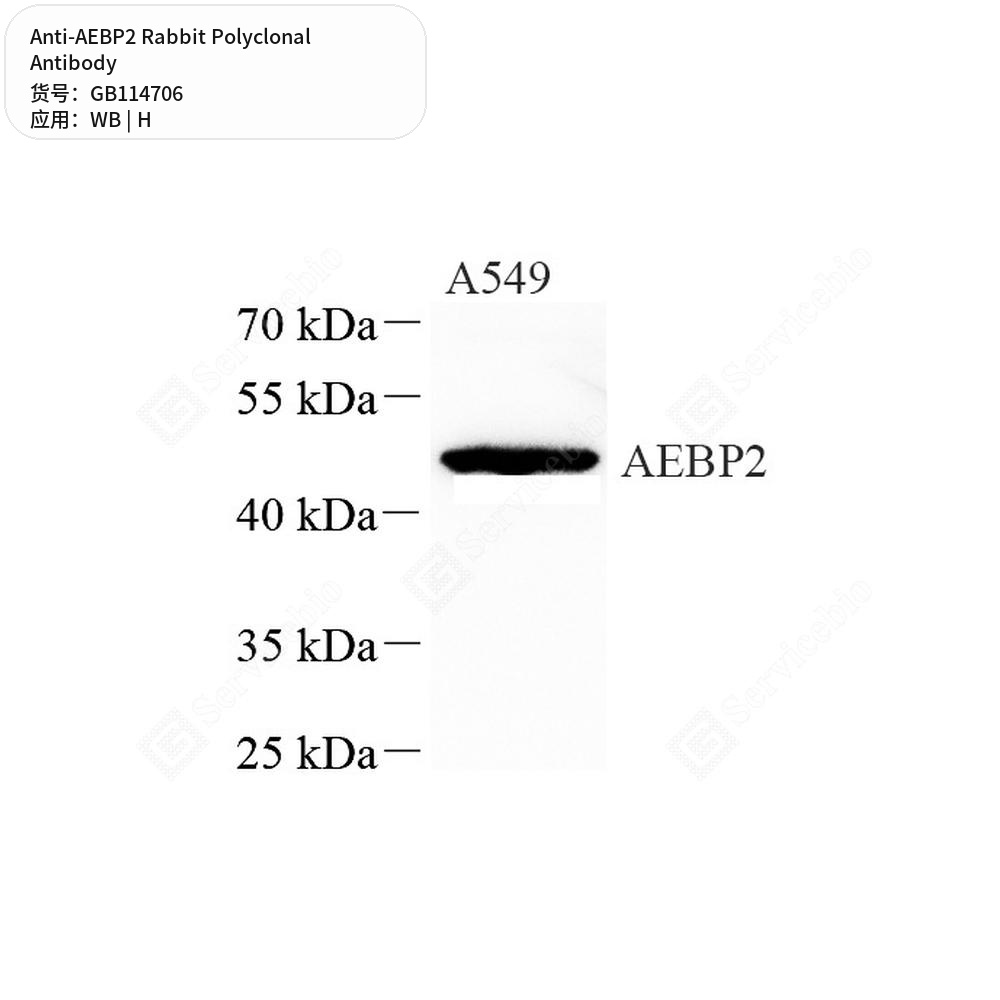 Антитела первичные, поликлональные кролика к AEBP2 человека, 50 мкл
