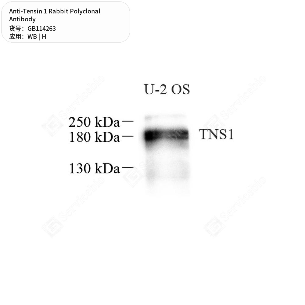 Антитела первичные, поликлональные кролика к Tensin 1 человека, 100 мкл