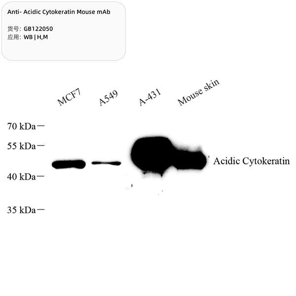 Антитела первичные, моноклональные, Acidic Cytokeratin, 100 мкл