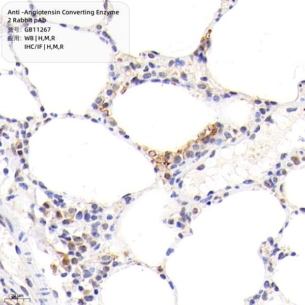 Антитела первичные, поликлональные, Angiotensin Converting Enzyme 2, 50 мкл