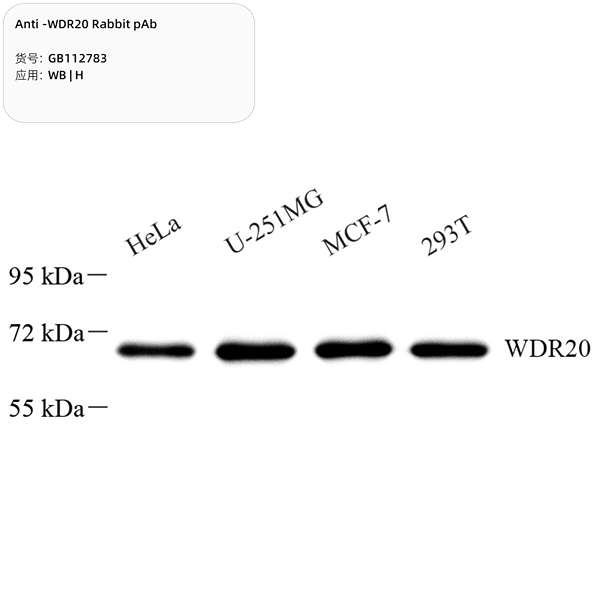 Антитела первичные, поликлональные, WDR20, 100 мкл