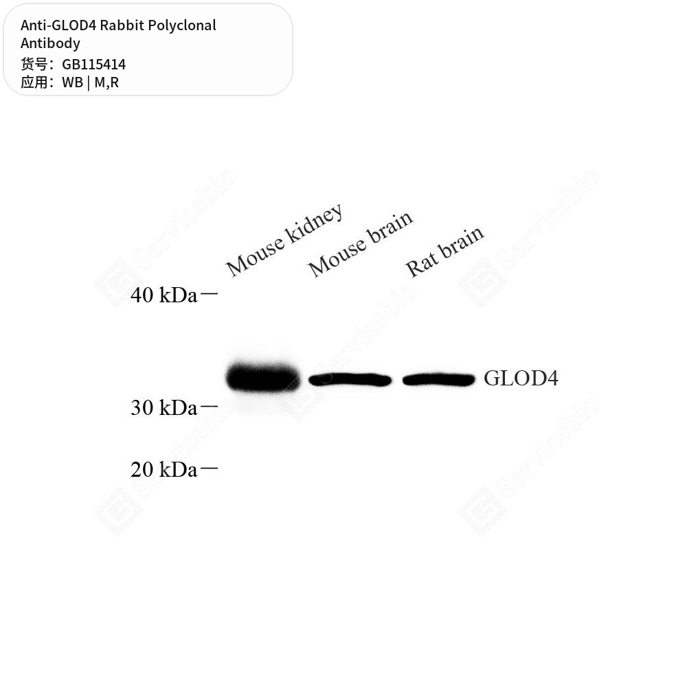 Антитела первичные, поликлональные кролика к GLOD4 крысы, мыши, 50 мкл