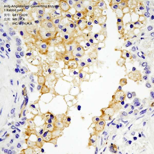 Антитела первичные, поликлональные, Angiotensin Converting Enzyme 1, 100 мкл