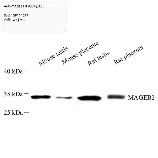 Антитела первичные, поликлональные, MAGEB2, 100 мкл