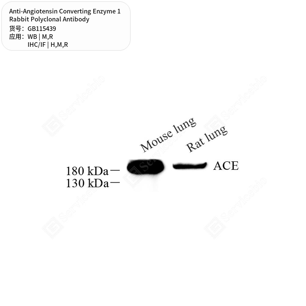 Антитела первичные, поликл. кролика к Angiotensin Converting Enzyme 1 крысы, мыши, человека, 50 мкл