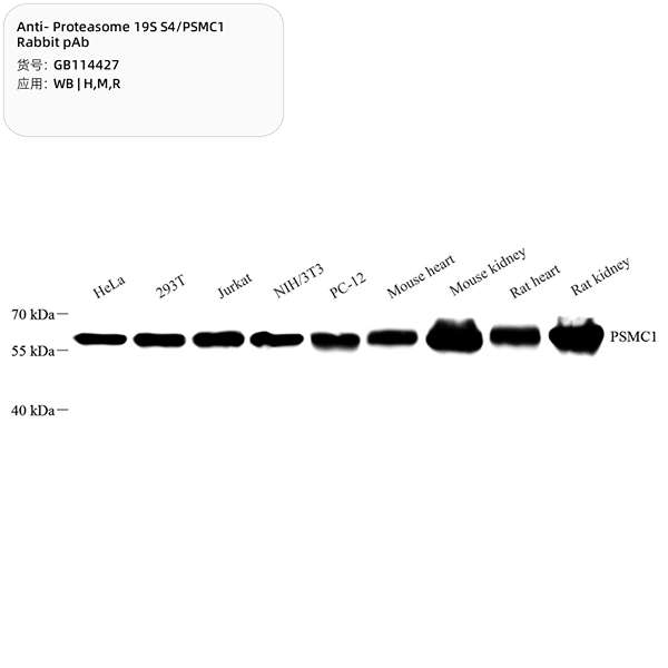 Антитела первичные, поликлональные, Proteasome 19S S4/PSMC1, 100 мкл