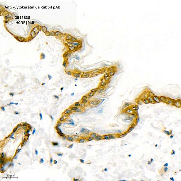 Антитела первичные, поликлональные, Cytokeratin 6a, 100 мкл