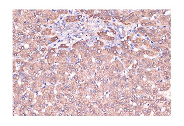Антитела первичные, моноклональные Haptoglobin (ARC1298), 100 мкл