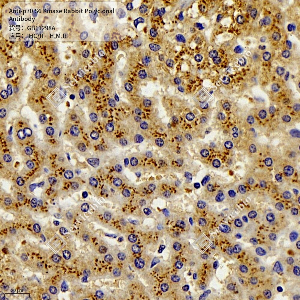Антитела первичные, поликлональные кролика к p70 S6 Kinase крысы, мыши, человека, 100 мкл