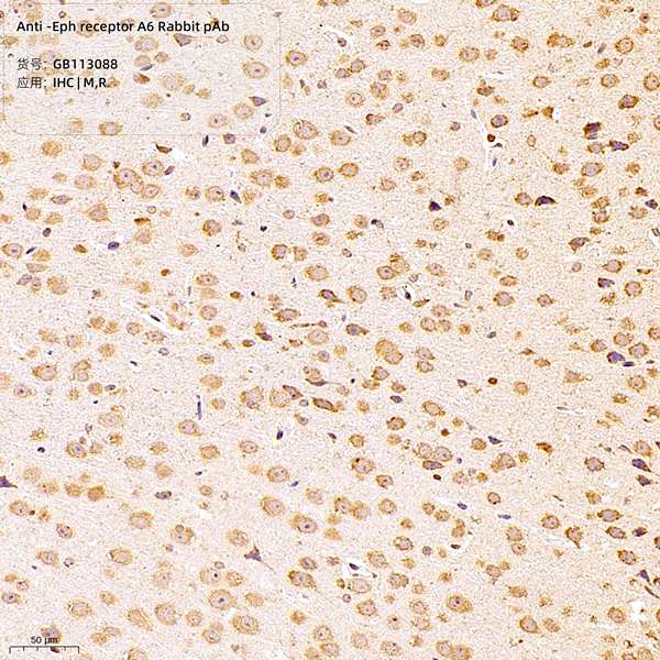 Антитела первичные, поликлональные, Eph receptor A6, 100 мкл