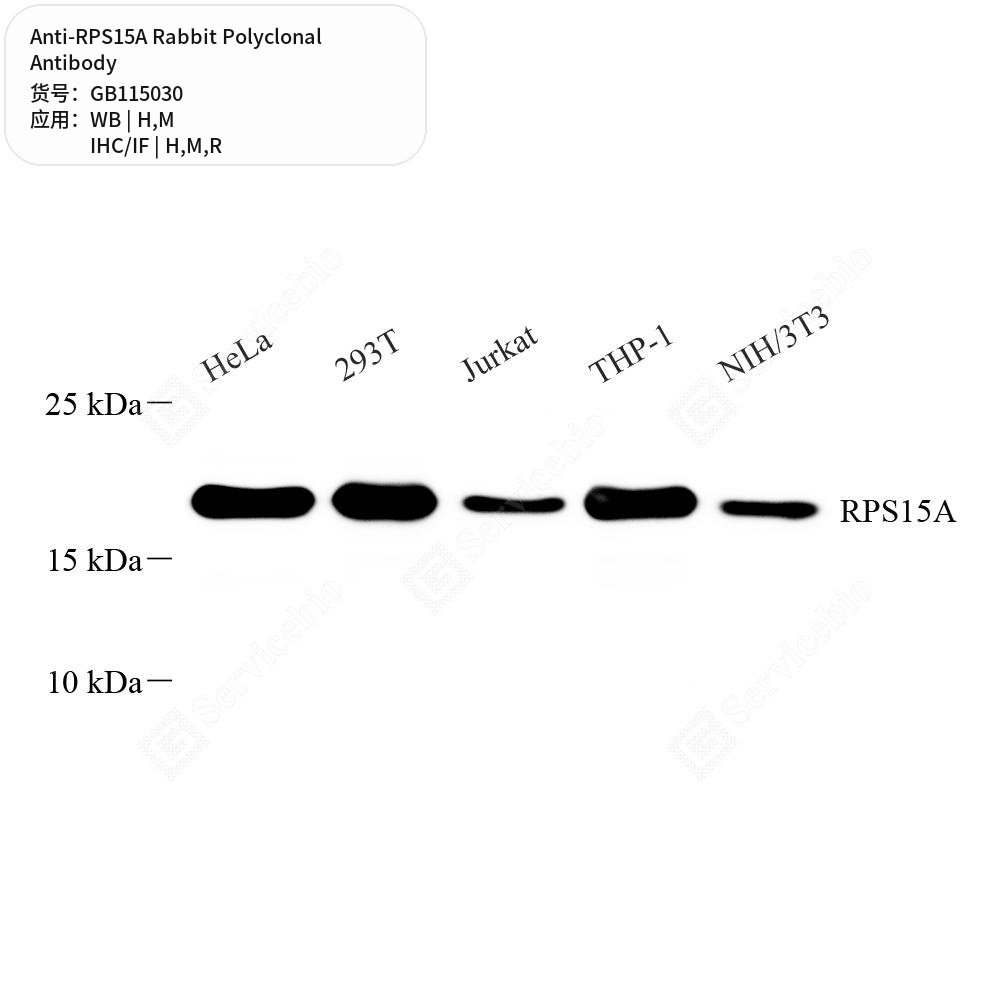 Антитела первичные, поликлональные кролика к RPS15A крысы, мыши, человека, 50 мкл