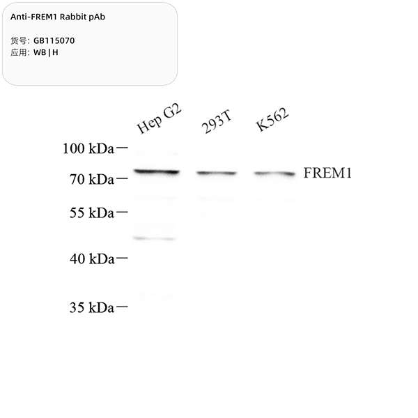 Антитела первичные, поликлональные, FREM1, 100 мкл