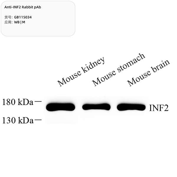 Антитела первичные, поликлональные, INF2, 100 мкл