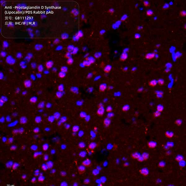 Антитела первичные, поликлональные, Prostaglandin D Synthase (Lipocalin)/PDS, 100 мкл