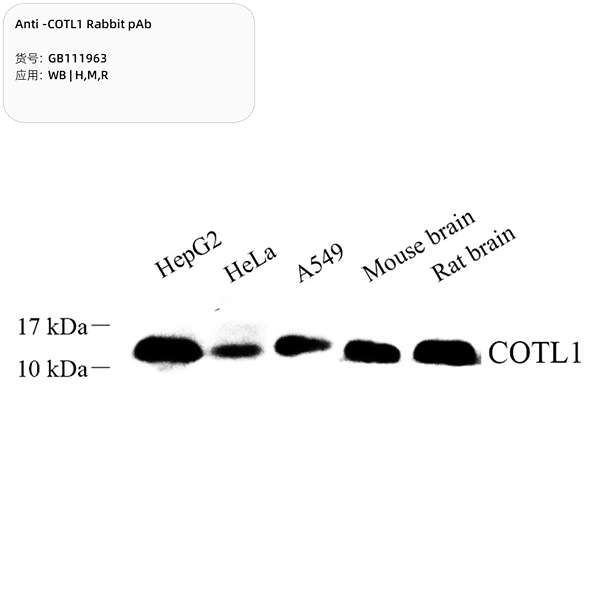 Антитела первичные, поликлональные, COTL1, 100 мкл