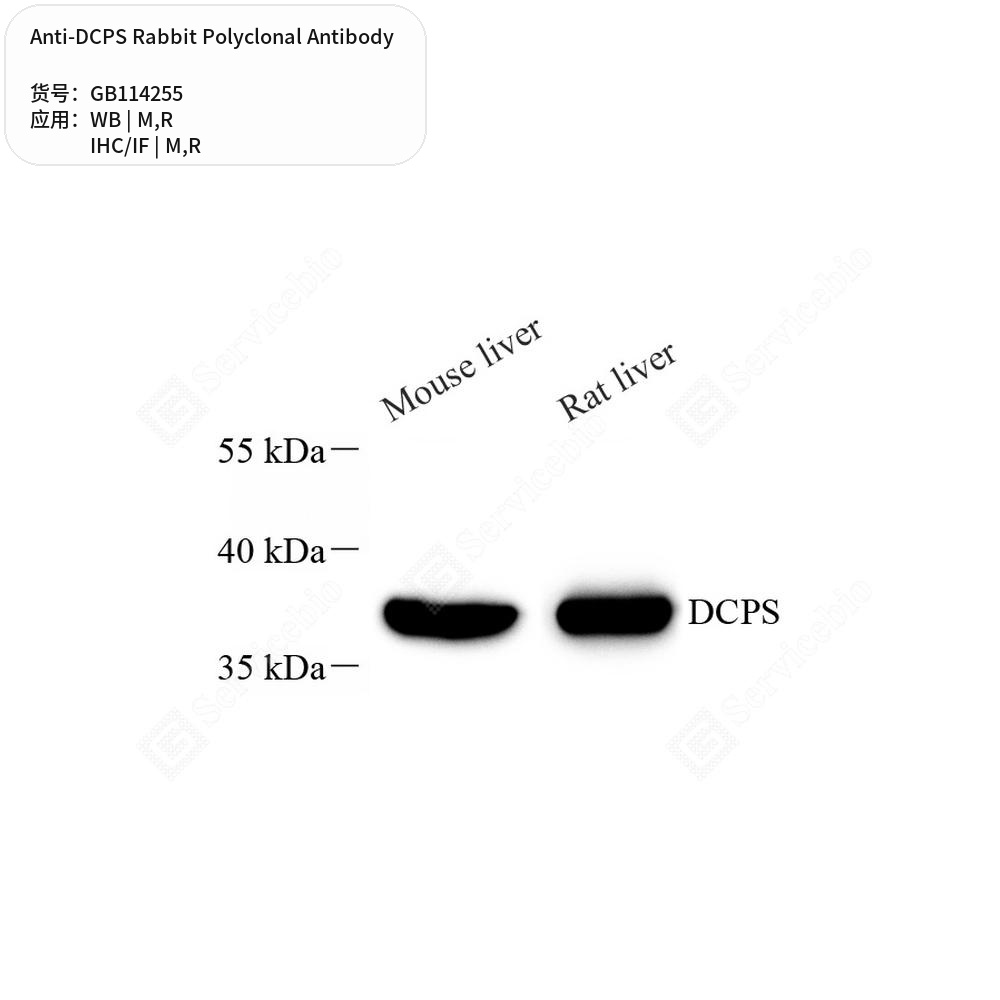 Антитела первичные, поликлональные кролика к DCPS крысы, мыши, 50 мкл