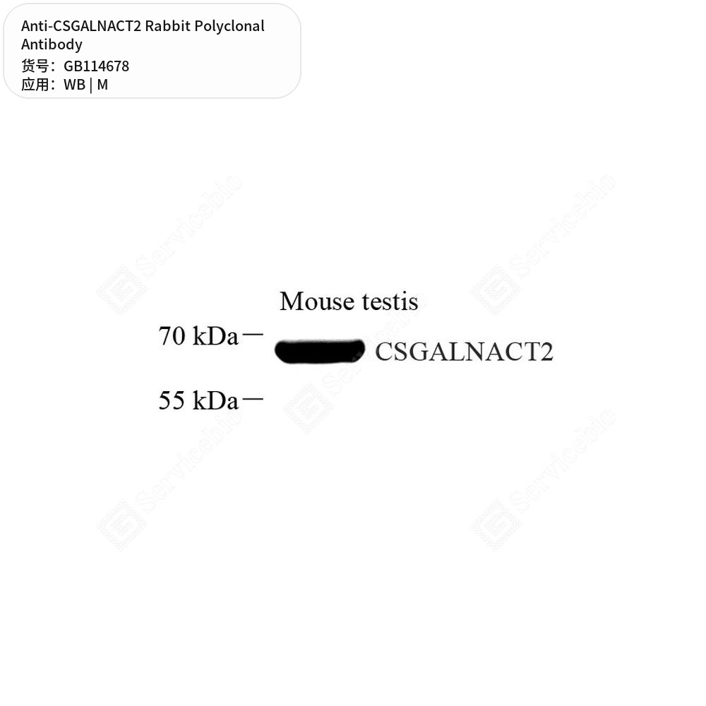 Антитела первичные, поликлональные кролика к CSGALNACT2 мыши, 100 мкл