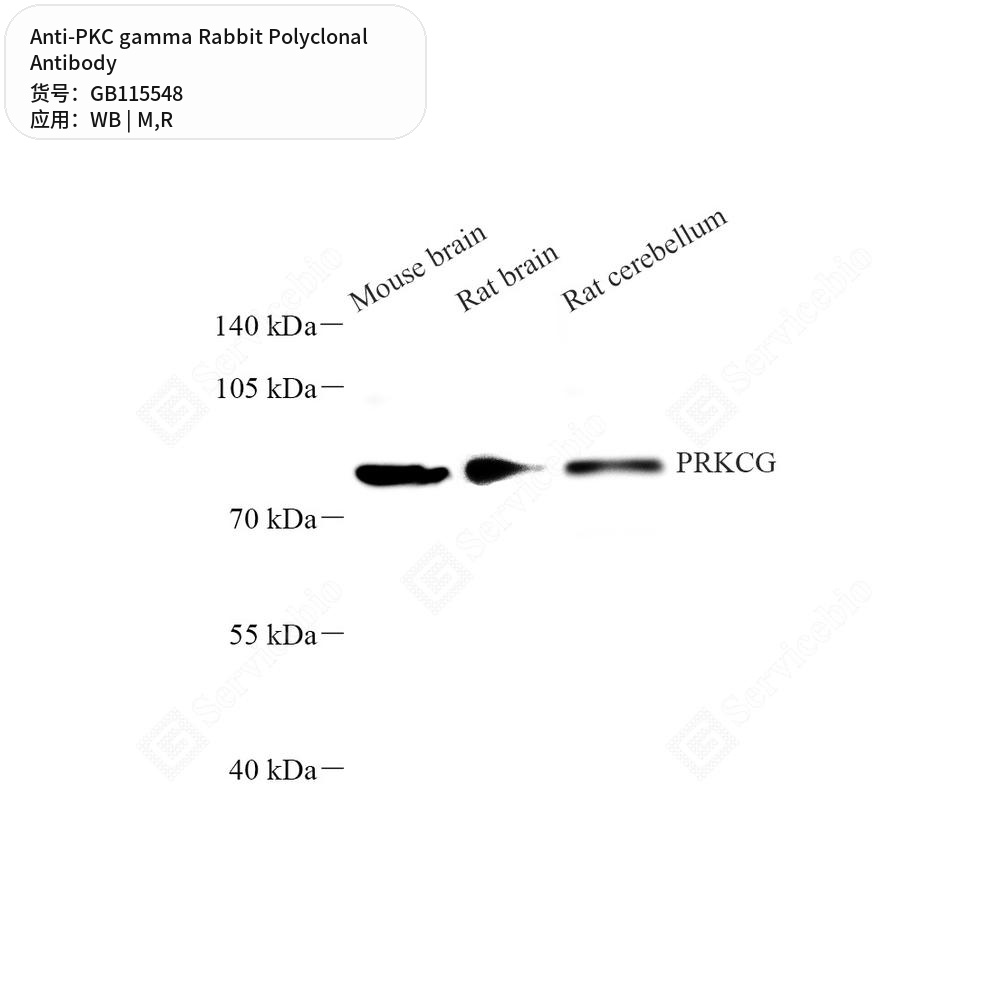 Антитела первичные, поликлональные кролика к PKC gamma крысы, мыши, 50 мкл