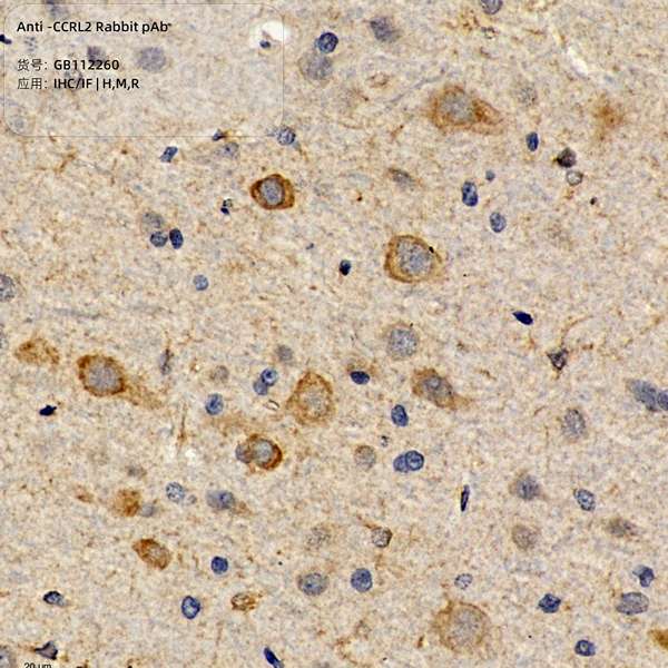 Антитела первичные, поликлональные, CCRL2, 100 мкл