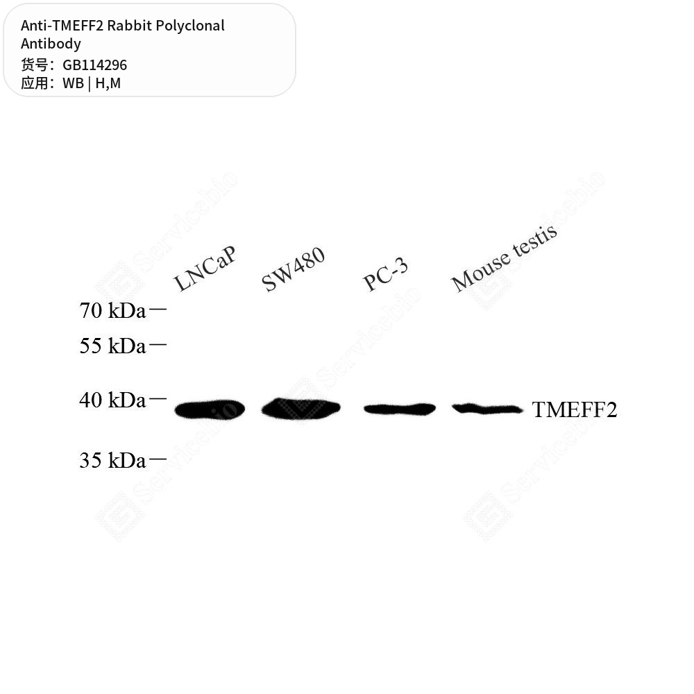Антитела первичные, поликлональные кролика к TMEFF2 мыши, человека, 50 мкл