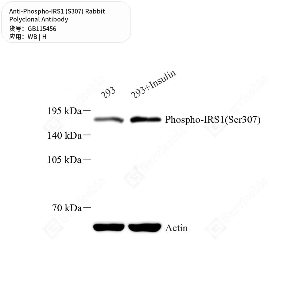 Антитела первичные, поликлональные кролика к Phospho-IRS1 (S307) человека, 50 мкл