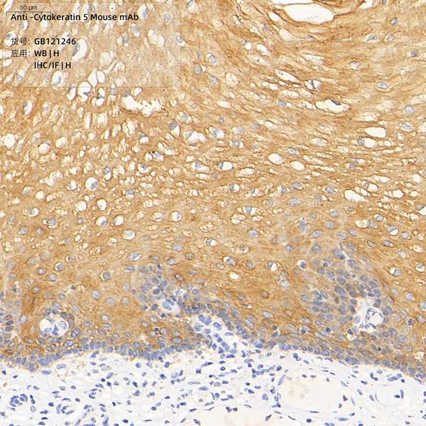 Антитела первичные, моноклональные, Cytokeratin 5, 100 мкл