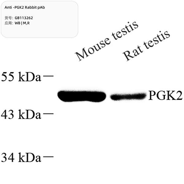 Антитела первичные, поликлональные, PGK2, 100 мкл