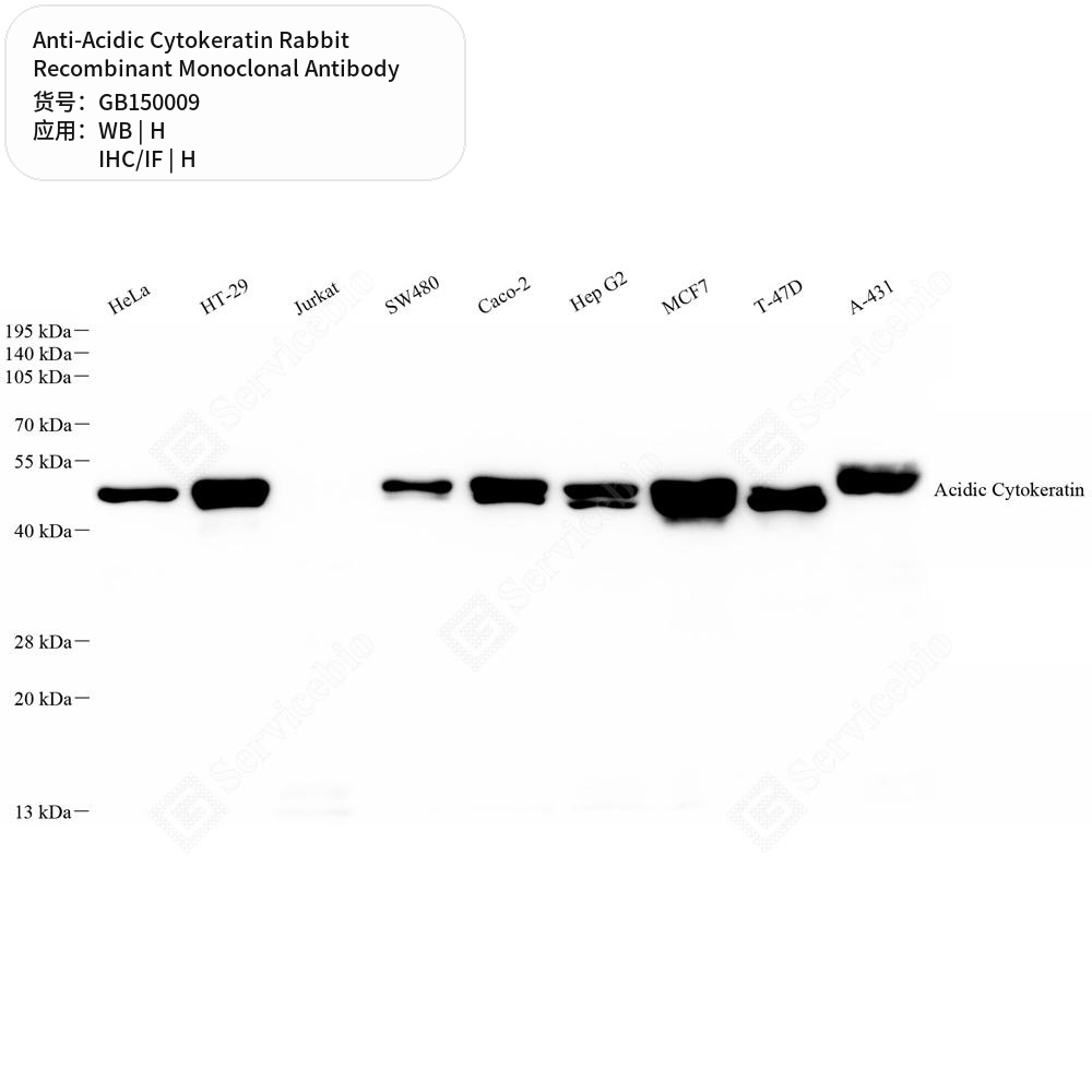 Антитела первичные, моноклональные кролика к Acidic Cytokeratin человека, 50 мкл