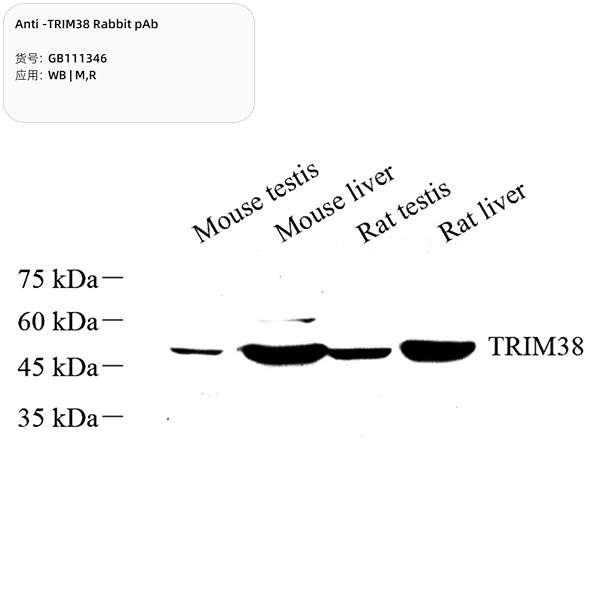 Антитела первичные, поликлональные, TRIM38, 100 мкл