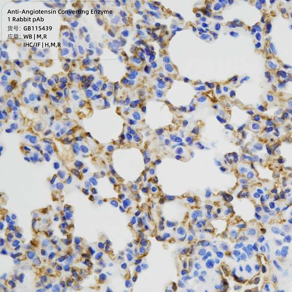 Антитела первичные, поликлональные, Angiotensin Converting Enzyme 1, 100 мкл