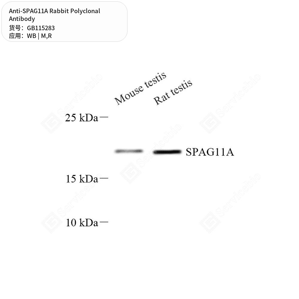 Антитела первичные, поликлональные кролика к SPAG11A крысы, мыши, 50 мкл