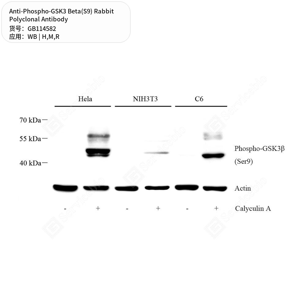 Антитела первичные, поликлональные кролика к Phospho-GSK3 Beta(S9) крысы, мыши, человека, 100 мкл