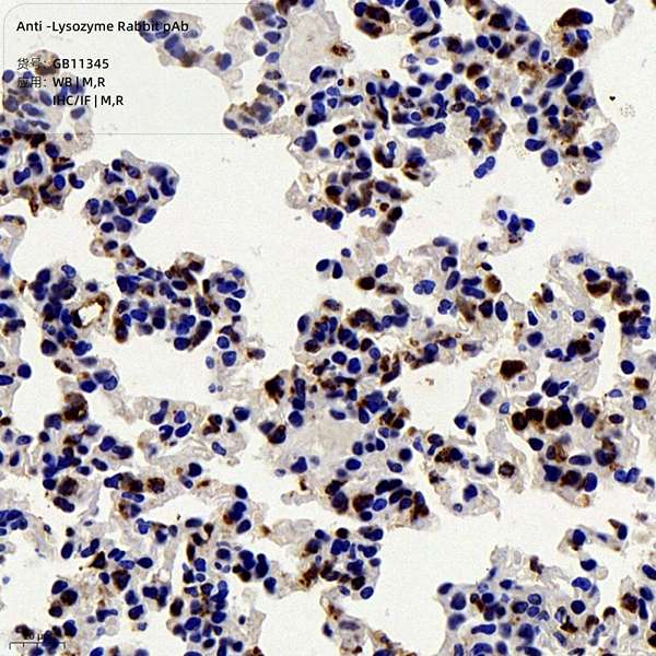 Антитела первичные, поликлональные, Lysozyme, 100 мкл