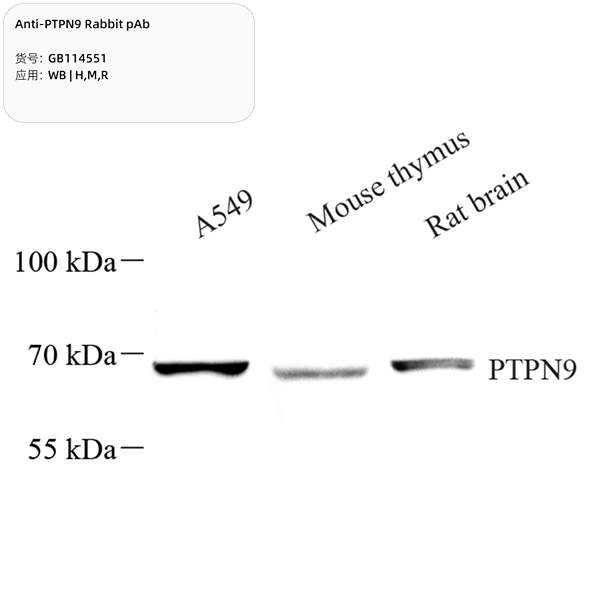 Антитела первичные, поликлональные, PTPN9, 100 мкл