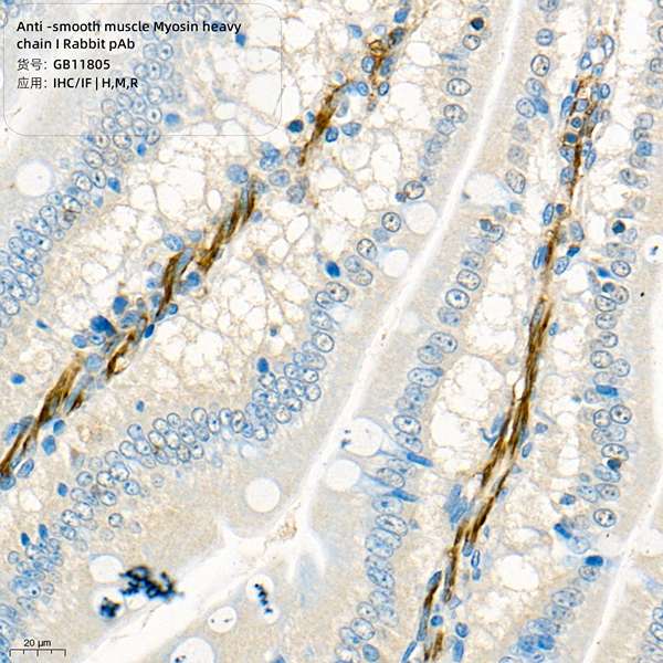 Антитела первичные, поликлональные, smooth muscle Myosin heavy chain 11, 100 мкл