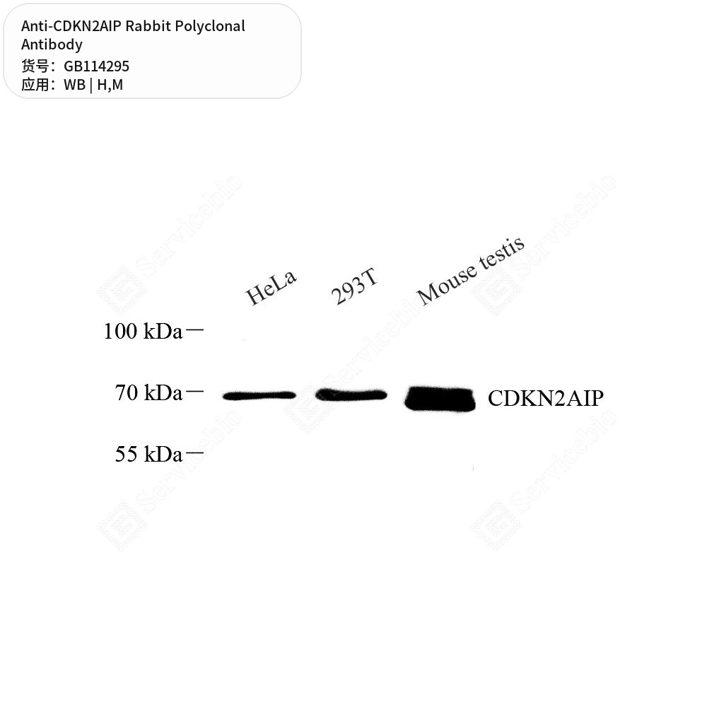 Антитела первичные, поликлональные кролика к CDKN2AIP мыши, человека, 50 мкл