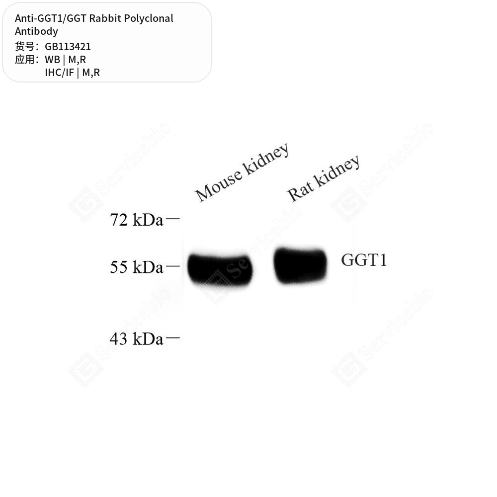 Антитела первичные, поликлональные кролика к GGT1/GGT крысы, мыши, 100 мкл