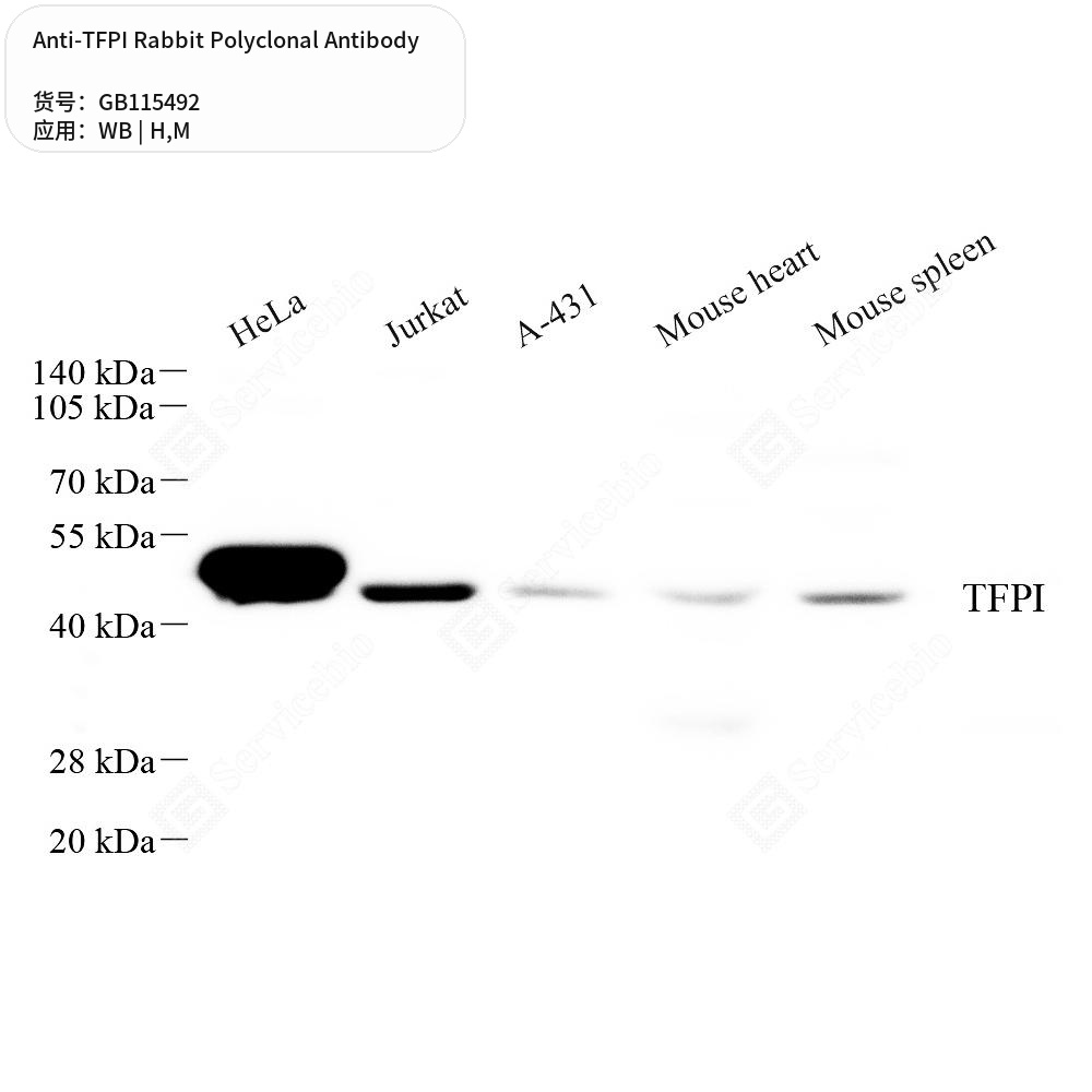 Антитела первичные, поликлональные кролика к TFPI мыши, человека, 50 мкл