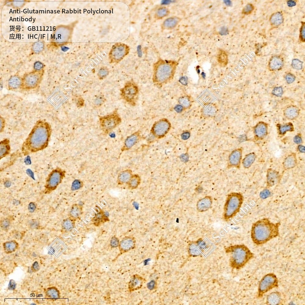 Антитела первичные, поликлональные кролика к Glutaminase крысы, мыши, 100 мкл
