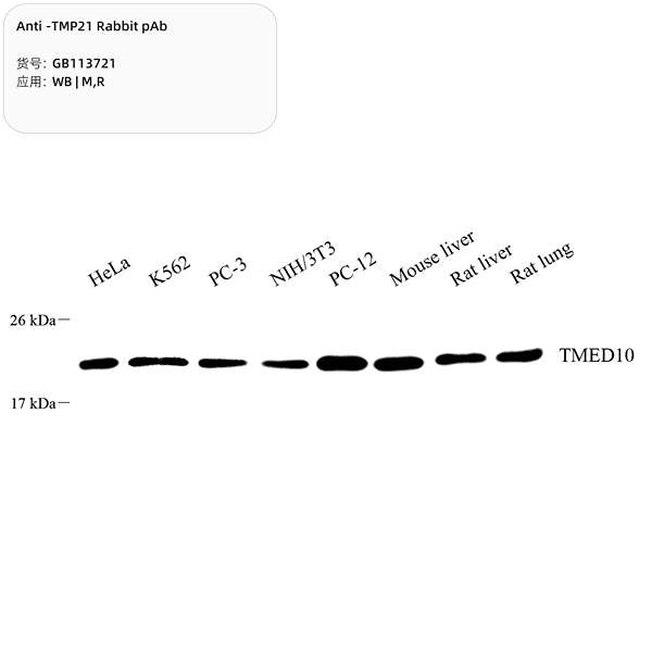 Антитела первичные, поликлональные, TMP21, 100 мкл